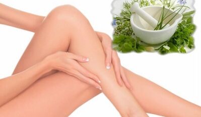 Tratamiento de las venas varicosas de las extremidades inferiores con remedios populares