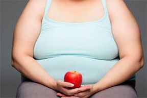 Para curar las varices es necesario perder peso.