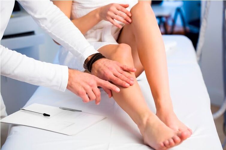 Diagnóstico de varices en las piernas.