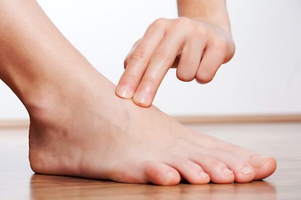 Pierna sin varices tras tratamiento con láser