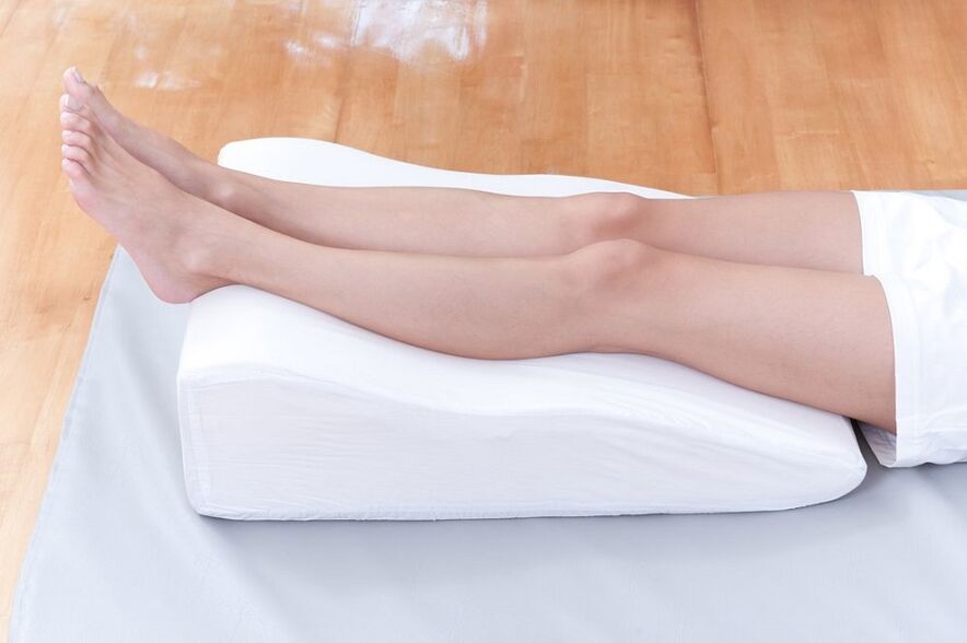venas varicosas en las piernas