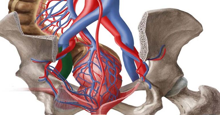 Venas varicosas de la pelvis. 